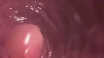 VAGINA INSIDE 3D PERSPECTIVE