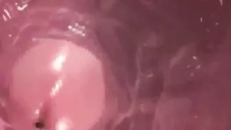 VAGINA INSIDE 3D PERSPECTIVE